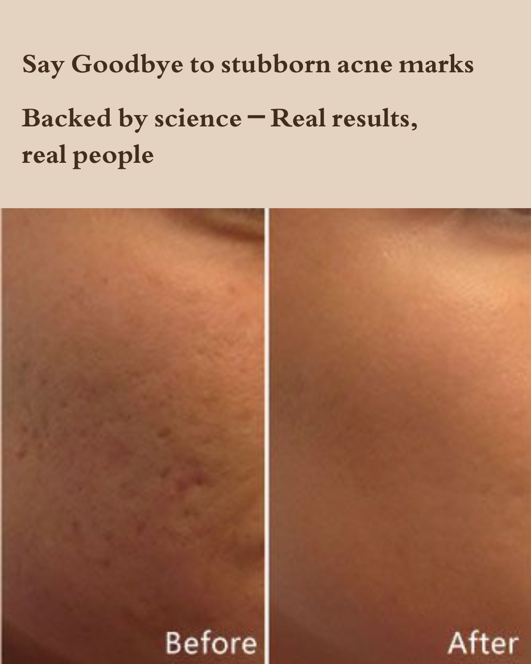 Rejuage Cream- Multifunctional Powerful Youth Moisturiser : Enriched with Bifida Ferment Lystate