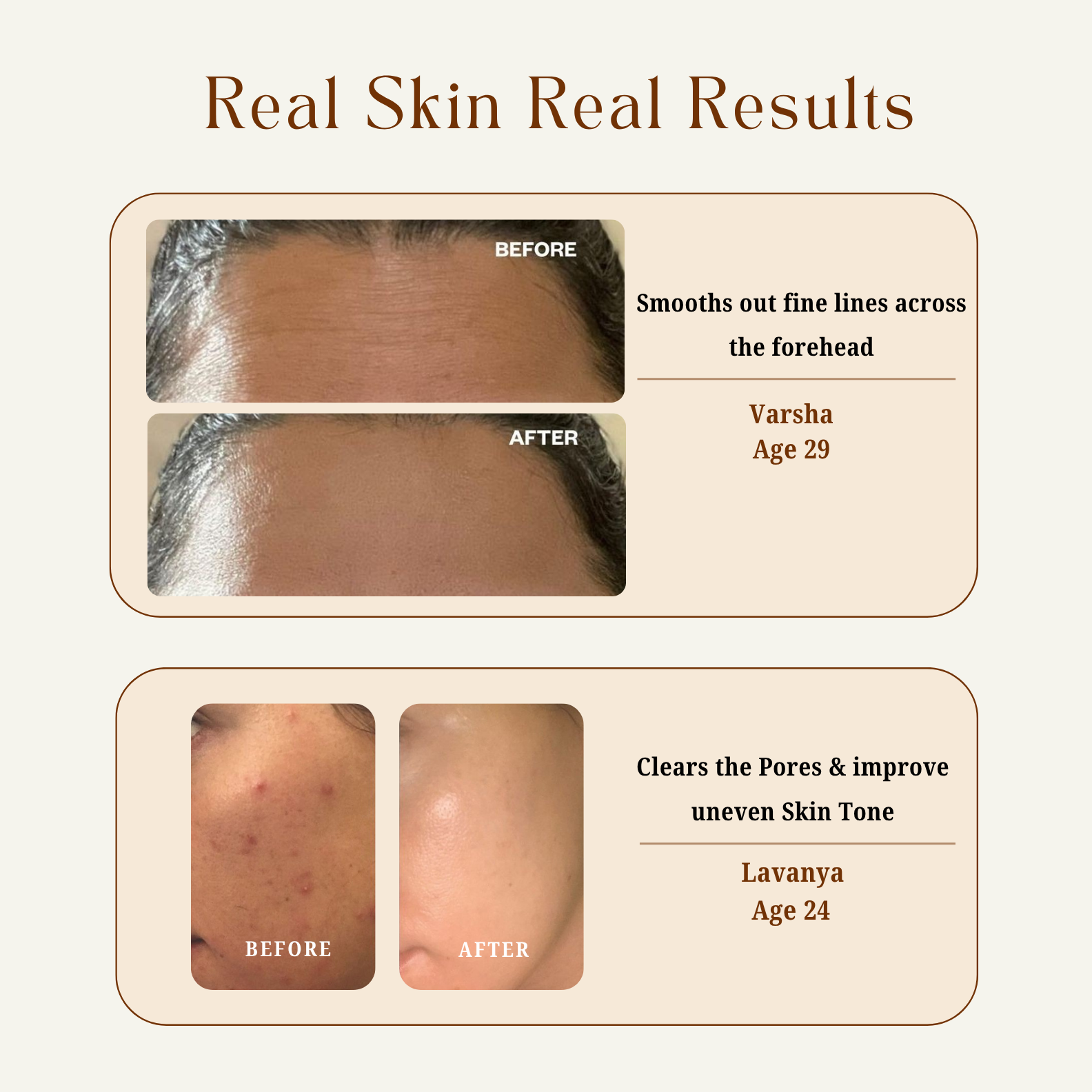 Rejuage Multifunctional Powerful Youth Moisturiser Cream